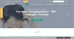 Desktop Screenshot of hairtransplantations.eu